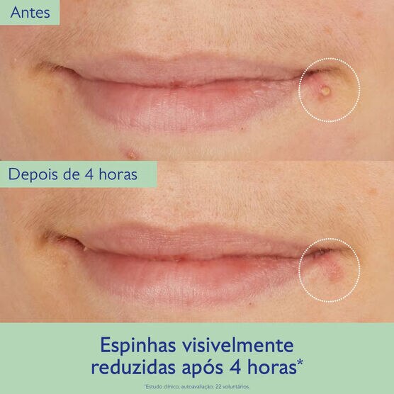 Solução Secativa Salicílica Caudalie Vinopure
